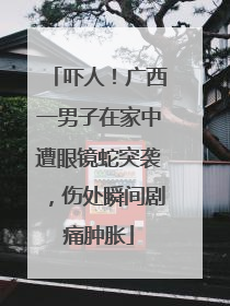 吓人！广西一男子在家中遭眼镜蛇突袭，伤处瞬间剧痛肿胀